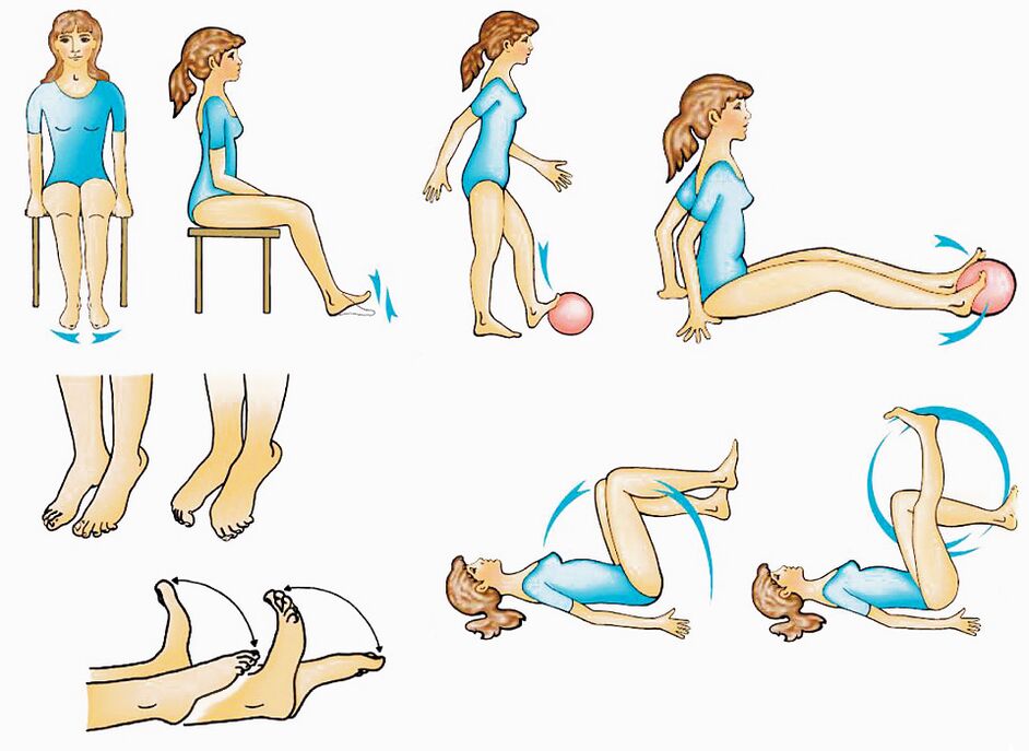 Physical exercises for varicose veins