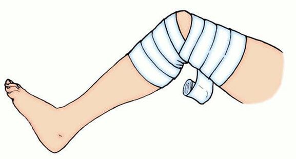 Elastic association